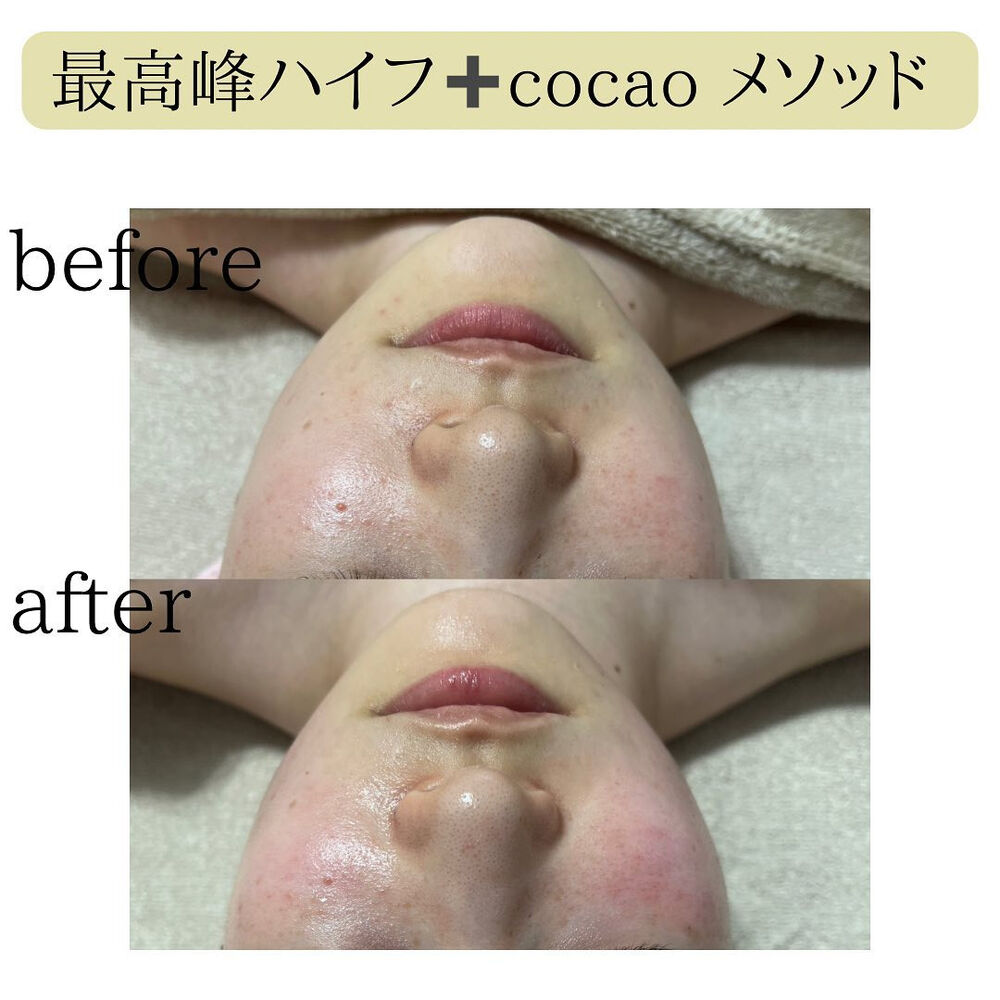 画像1322