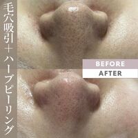 画像1339