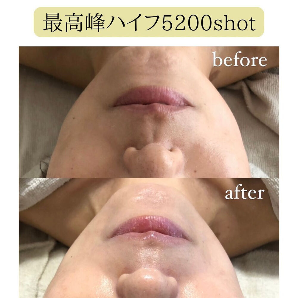 画像1345