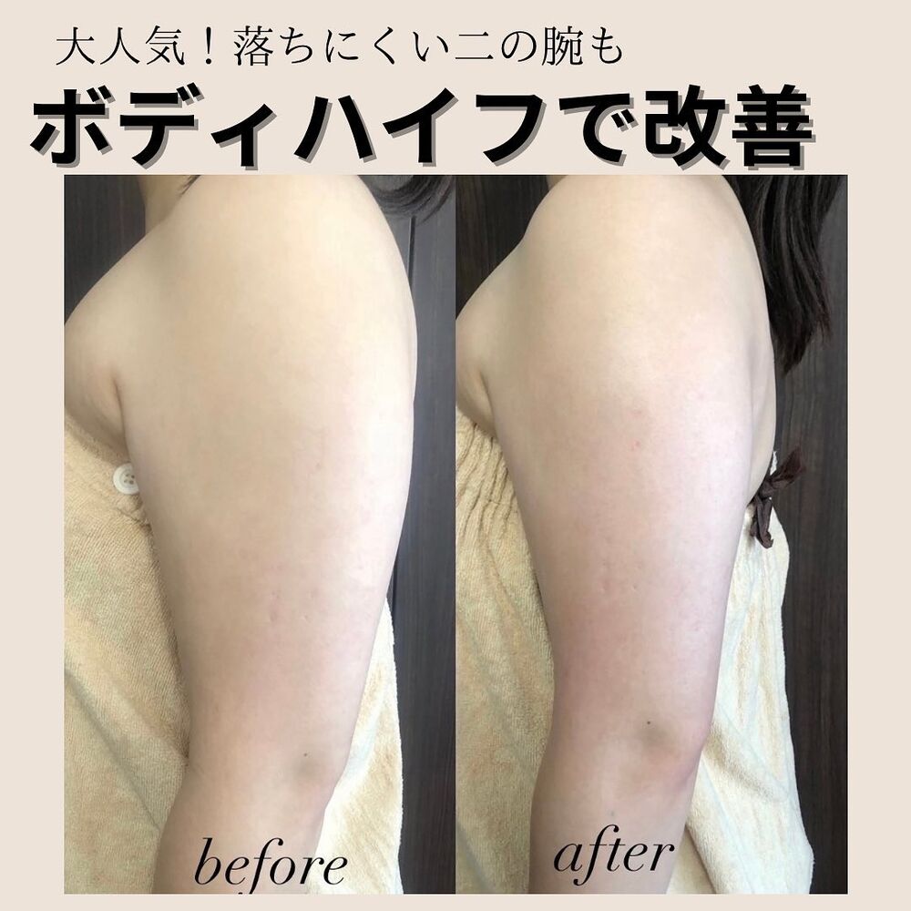 画像1404