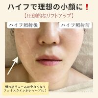 画像1429
