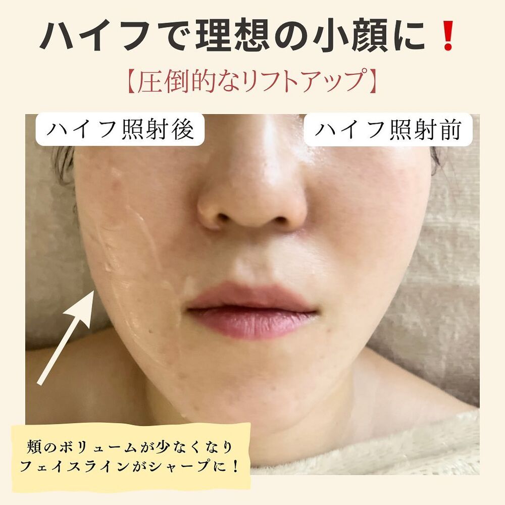 画像1429