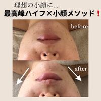画像1432
