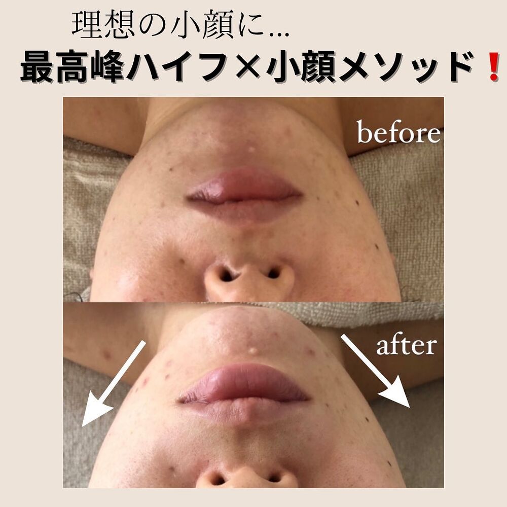画像1432