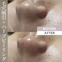 画像1511