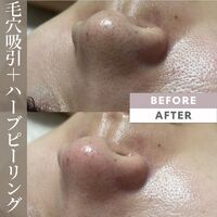 画像1541