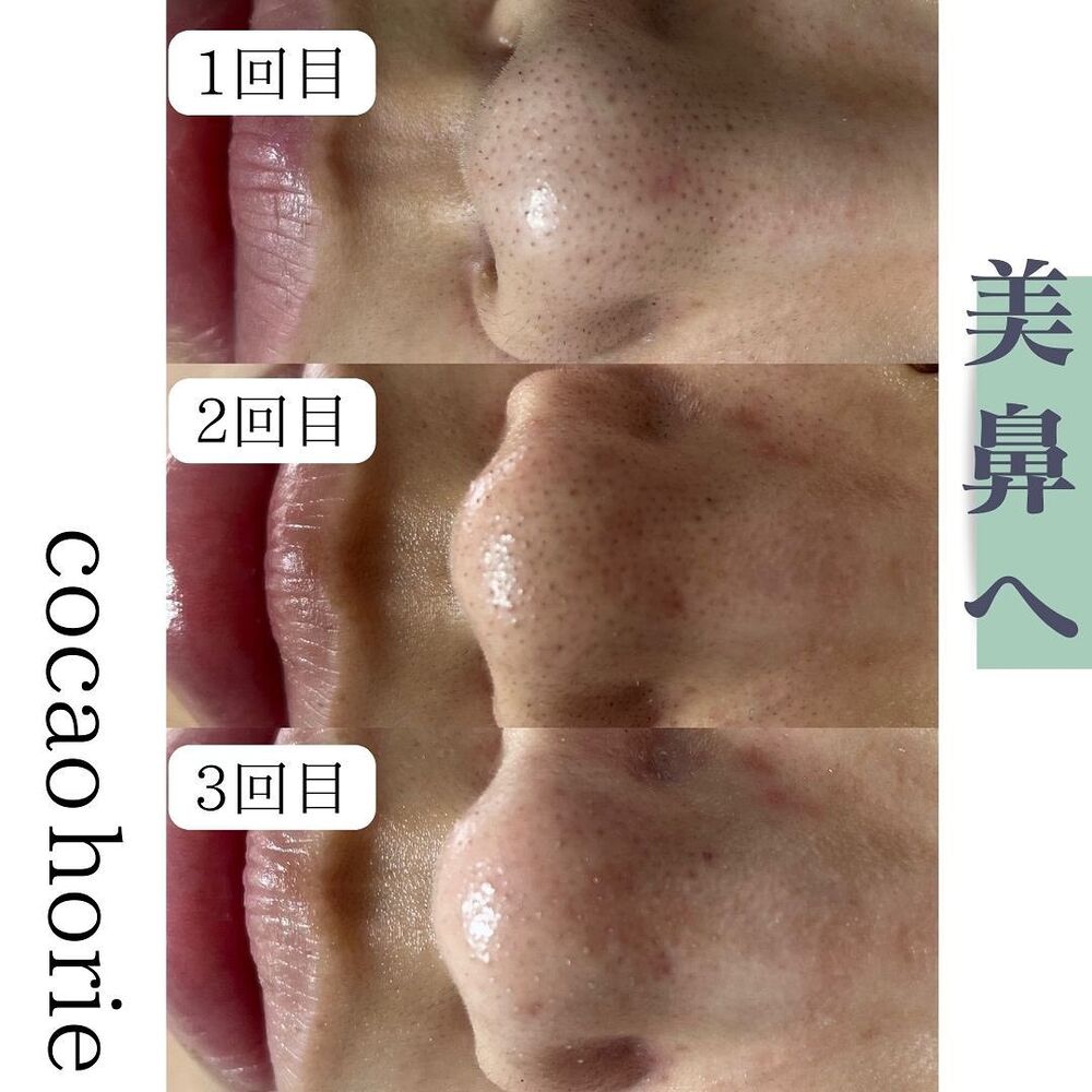 画像1560