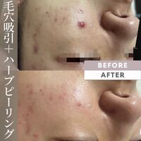 画像1567