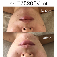 画像1580