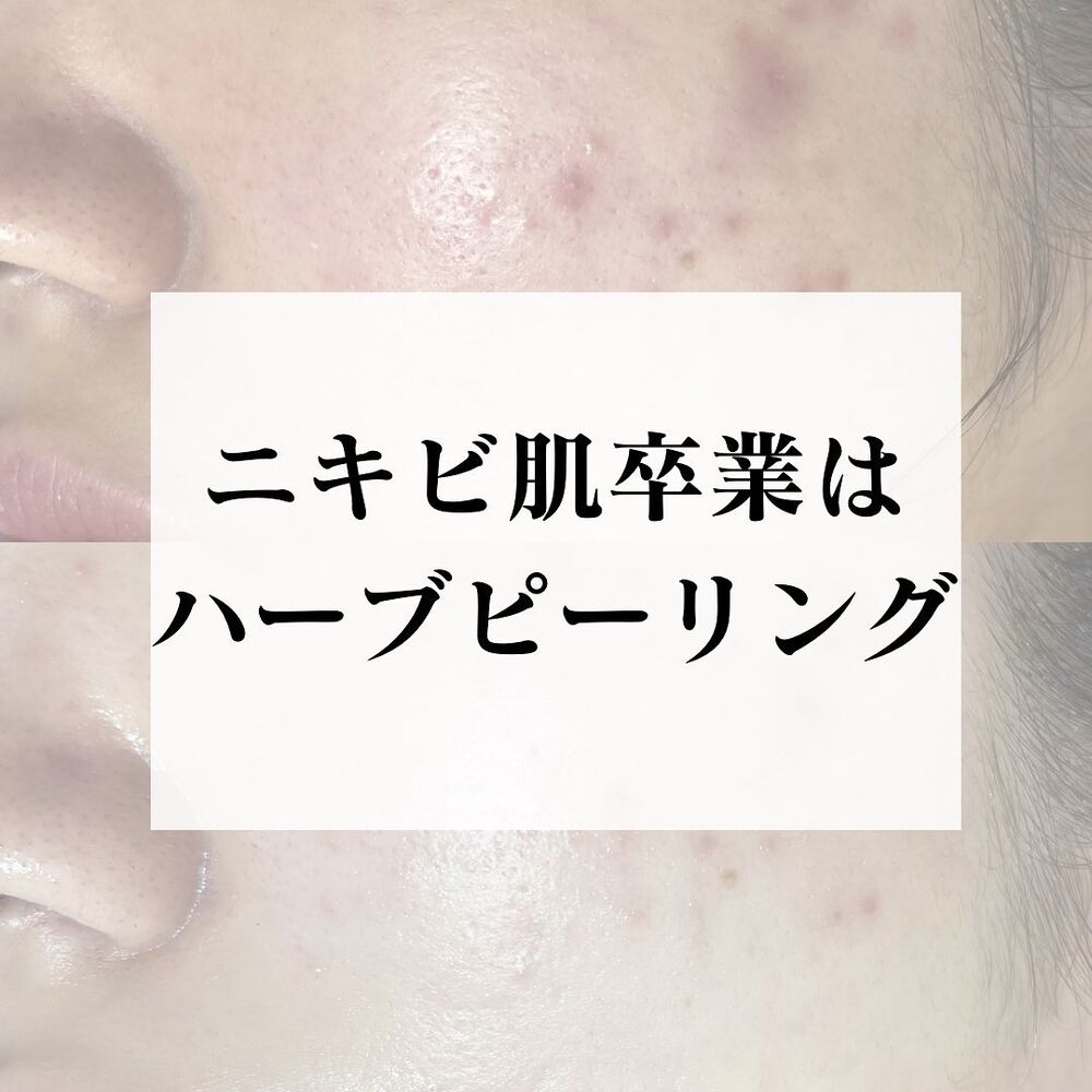 画像1628